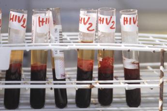 Hiv, esperti: “Con nuove terapie più pazienti seguiti sul territorio”