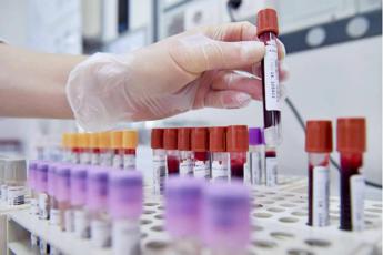 Morbillo rialza la testa in Ue, si riunisce Comitato di sicurezza