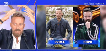 Francesco Facchinetti, la battaglia contro la calvizie: “Ho trovato la pace con una patch cutanea”